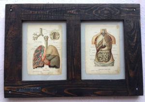 Anatomia-1900-ram-stare-drevo